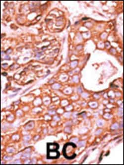 Invitrogen PPM1F Polyclonal Antibody 400 &mu;L; Unconjugated:Antibodies,