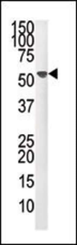 Invitrogen PPM1F Polyclonal Antibody 400 &mu;L; Unconjugated:Antibodies,