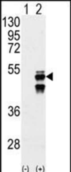 Invitrogen PPM1F Polyclonal Antibody 400 &mu;L; Unconjugated:Antibodies,