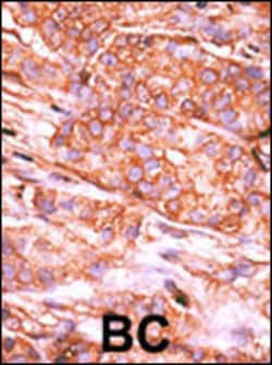 Invitrogen CTDSP2 Polyclonal Antibody 400 &mu;L; Unconjugated:Antibodies,