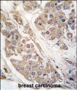 Invitrogen CTDSP2 Polyclonal Antibody 400 &mu;L; Unconjugated:Antibodies,