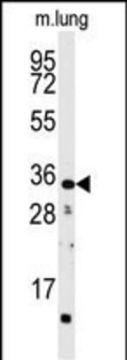 Invitrogen CTDSP2 Polyclonal Antibody 400 &mu;L; Unconjugated:Antibodies,