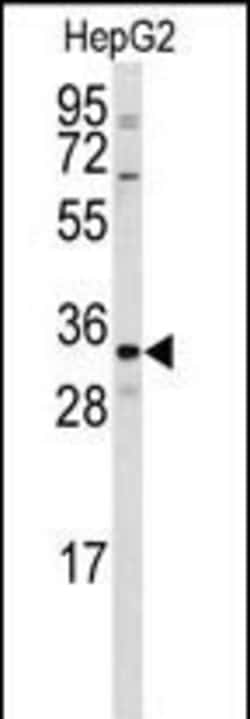 Invitrogen CTDSP2 Polyclonal Antibody 400 &mu;L; Unconjugated:Antibodies,