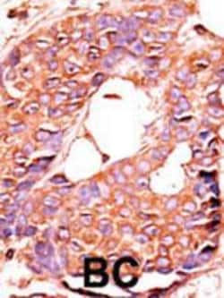 Invitrogen PPP6C Polyclonal Antibody 400 &mu;L; Unconjugated:Antibodies,