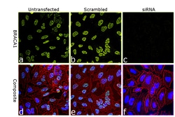 Invitrogen BRCA1 Polyclonal Antibody 100 μL; Unconjugated:Antibodies,