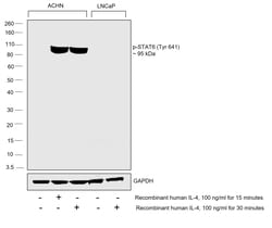Invitrogen Phospho-STAT6 (Tyr641) Polyclonal Antibody 100 &mu;L | Buy Online | Invitrogen&trade; | Fisher Scientific