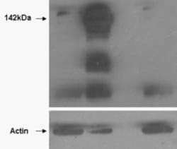 Invitrogen Tankyrase Polyclonal Antibody 100 μg; Unconjugated:Antibodies,