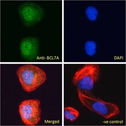 Invitrogen BCL7A Polyclonal Antibody 100 &mu;g; Unconjugated:Antibodies,
