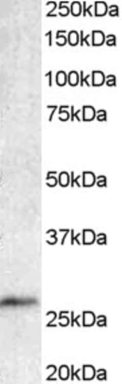 Invitrogen BCL7A Polyclonal Antibody 100 &mu;g; Unconjugated:Antibodies,