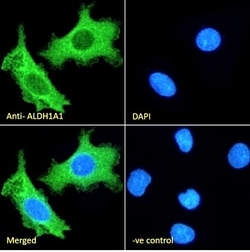 Invitrogen ALDH1A1 Polyclonal Antibody 100 μg; Unconjugated:Antibodies,