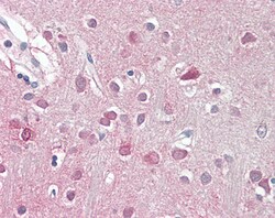 Invitrogen ORC3 Polyclonal Antibody 100 &mu;g; Unconjugated:Antibodies,