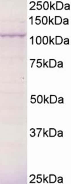Invitrogen BCAR3 Polyclonal Antibody 100 &mu;g; Unconjugated:Antibodies,