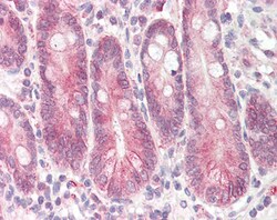 Invitrogen STAP2 Polyclonal Antibody 100 &mu;g; Unconjugated:Antibodies,