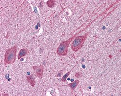 Invitrogen STAP2 Polyclonal Antibody 100 &mu;g; Unconjugated:Antibodies,