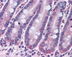 Invitrogen STAP2 Polyclonal Antibody 100 &mu;g; Unconjugated:Antibodies,