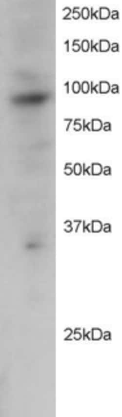 Invitrogen PRAM1 Polyclonal Antibody 100 &mu;g | Buy Online | Invitrogen&trade; | Fisher Scientific