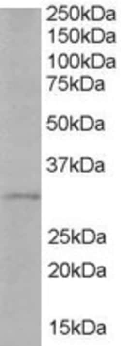Invitrogen TIRAP Polyclonal Antibody 100 &mu;g | Buy Online | Invitrogen&trade; | Fisher Scientific