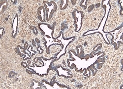 Invitrogen MKP-1 Polyclonal Antibody 100 &mu;g; Unconjugated:Antibodies,