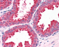 Invitrogen MKP-1 Polyclonal Antibody 100 &mu;g; Unconjugated:Antibodies,
