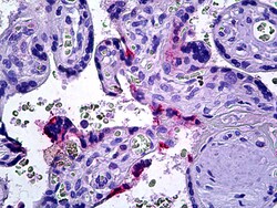 Invitrogen DOK3 Polyclonal Antibody 100 &mu;g; Unconjugated:Antibodies,