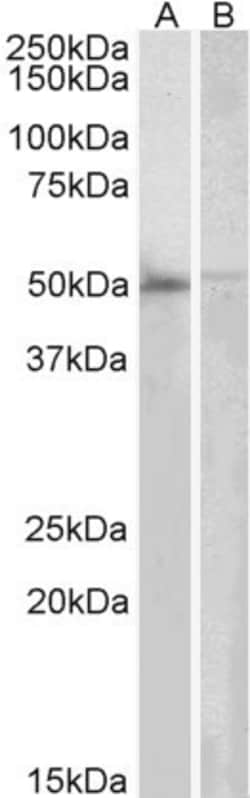 Invitrogen DOK3 Polyclonal Antibody 100 &mu;g; Unconjugated:Antibodies,