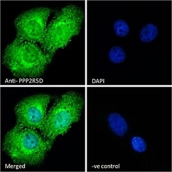 Invitrogen PPP2R5D Polyclonal Antibody 100 &mu;g; Unconjugated:Antibodies,