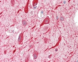 Invitrogen PPP2R5A Polyclonal Antibody 100 &mu;g; Unconjugated:Antibodies,