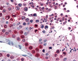 Invitrogen ATF7 Polyclonal Antibody 100 &mu;g; Unconjugated:Antibodies,
