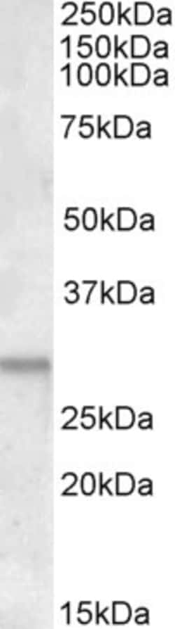 Invitrogen ATF5 Polyclonal Antibody 100 &mu;g; Unconjugated:Antibodies,