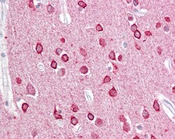 Invitrogen PACSIN1 Polyclonal Antibody 100 &mu;g; Unconjugated:Antibodies,