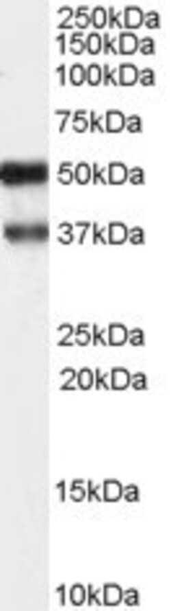 Invitrogen PACSIN1 Polyclonal Antibody 100 &mu;g; Unconjugated:Antibodies,