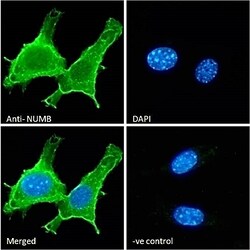 Invitrogen NUMB Polyclonal Antibody 100 μg; Unconjugated:Antibodies,