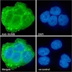 Invitrogen NUMB Polyclonal Antibody 100 μg; Unconjugated:Antibodies,