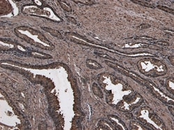 Invitrogen NUMB Polyclonal Antibody 100 μg; Unconjugated:Antibodies,