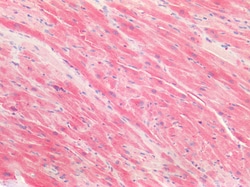 Invitrogen NUMB Polyclonal Antibody 100 μg; Unconjugated:Antibodies,