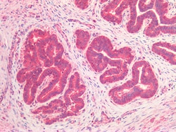 Invitrogen NUMB Polyclonal Antibody 100 μg; Unconjugated:Antibodies,