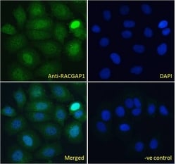 Invitrogen RACGAP1 Polyclonal Antibody 100 &mu;g; Unconjugated:Antibodies,
