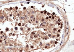 Invitrogen RACGAP1 Polyclonal Antibody 100 &mu;g; Unconjugated:Antibodies,