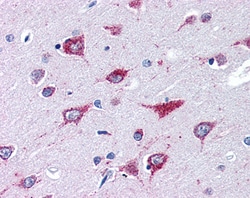 Invitrogen Alsin Polyclonal Antibody 100 &mu;g; Unconjugated:Antibodies,