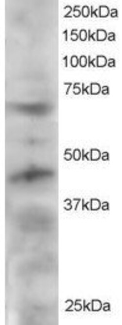 Invitrogen TRF1 Polyclonal Antibody 100 &mu;g | Buy Online | Invitrogen&trade; | Fisher Scientific