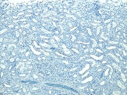 Invitrogen STUB1 Polyclonal Antibody 100 μg; Unconjugated:Antibodies,
