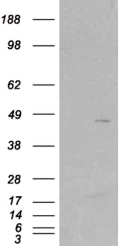 Invitrogen SKAP2 Polyclonal Antibody 100 &mu;g; Unconjugated:Antibodies,