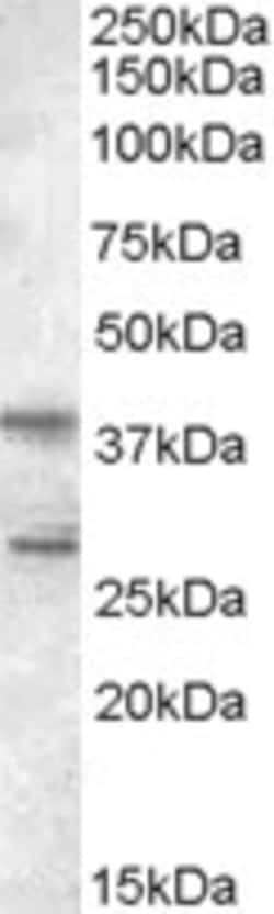 Invitrogen SKAP2 Polyclonal Antibody 100 &mu;g; Unconjugated:Antibodies,