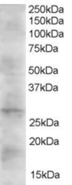 Invitrogen DKK2 Polyclonal Antibody 100 &mu;g | Buy Online | Invitrogen&trade; | Fisher Scientific