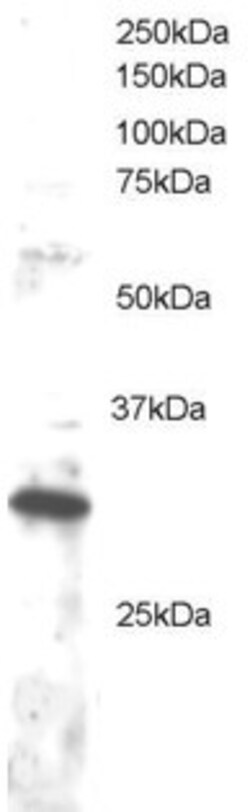 Invitrogen DKK4 Polyclonal Antibody 100 &mu;g; Unconjugated:Antibodies,