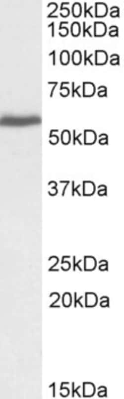 Invitrogen PRPF31 Polyclonal Antibody 100 &mu;g; Unconjugated:Antibodies,