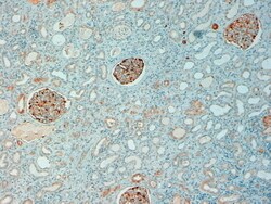 Invitrogen NQO1 Polyclonal Antibody 100 &mu;g; Unconjugated:Antibodies,