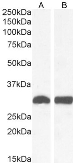 Invitrogen NQO1 Polyclonal Antibody 100 &mu;g; Unconjugated:Antibodies,