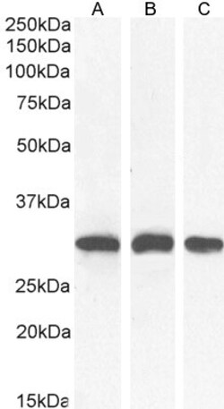 Invitrogen NQO1 Polyclonal Antibody 100 &mu;g; Unconjugated:Antibodies,