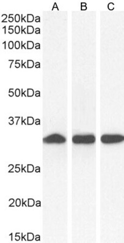 Invitrogen NQO1 Polyclonal Antibody 100 &mu;g; Unconjugated:Antibodies,